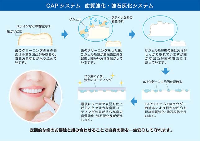 CAPシステム　歯質強化・共石灰化システム